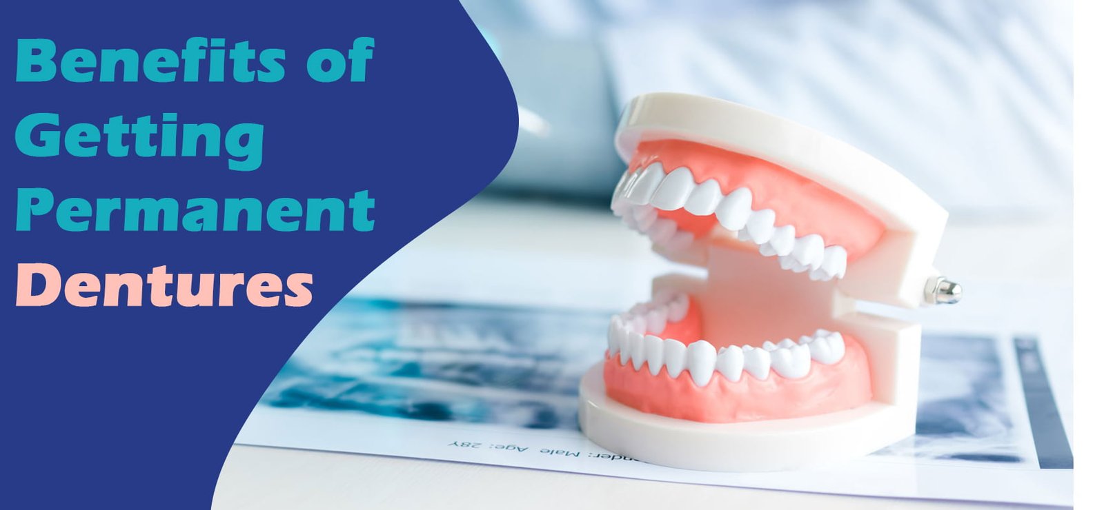 The Process and Benefits of Getting Permanent Dentures