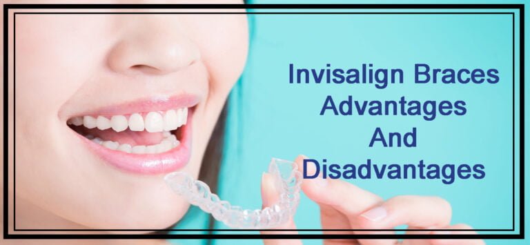 Invisalign Braces: Advantages And Disadvantages