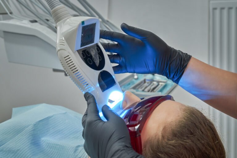 How long will your teeth whitening last after the treatment?