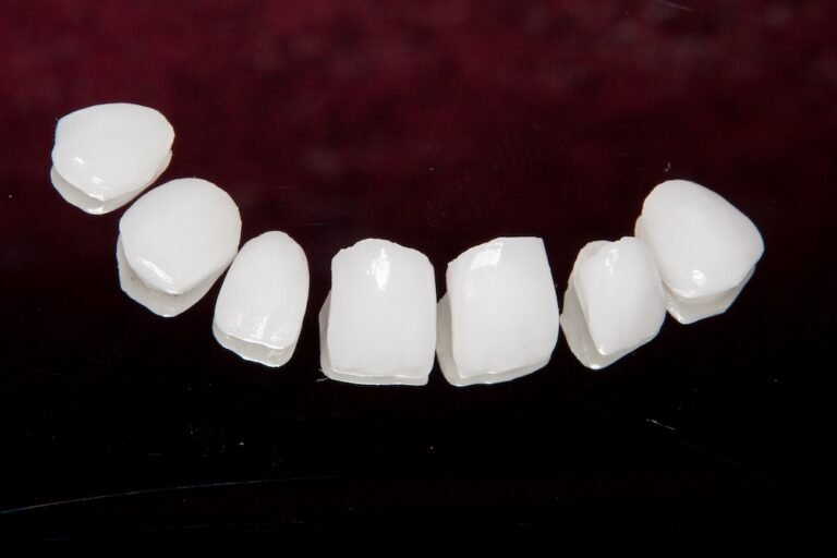 What are the key factors to consider when choosing dental crowns?