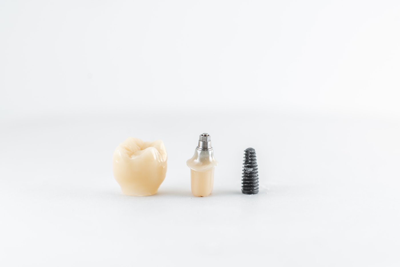 What are the things to consider before getting dental implants?