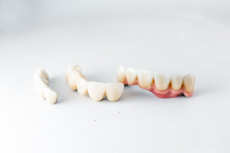 What are the situations that demand a crown replacement?