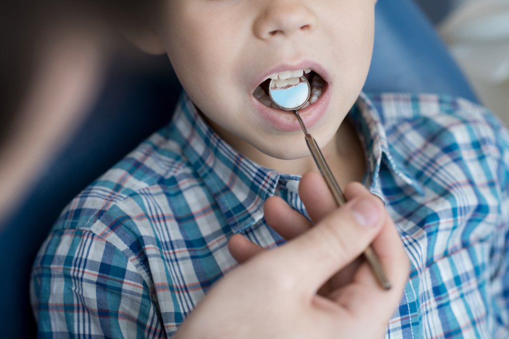 White Spots on Your Child’s Teeth: Causes and How a Dentist Can Help