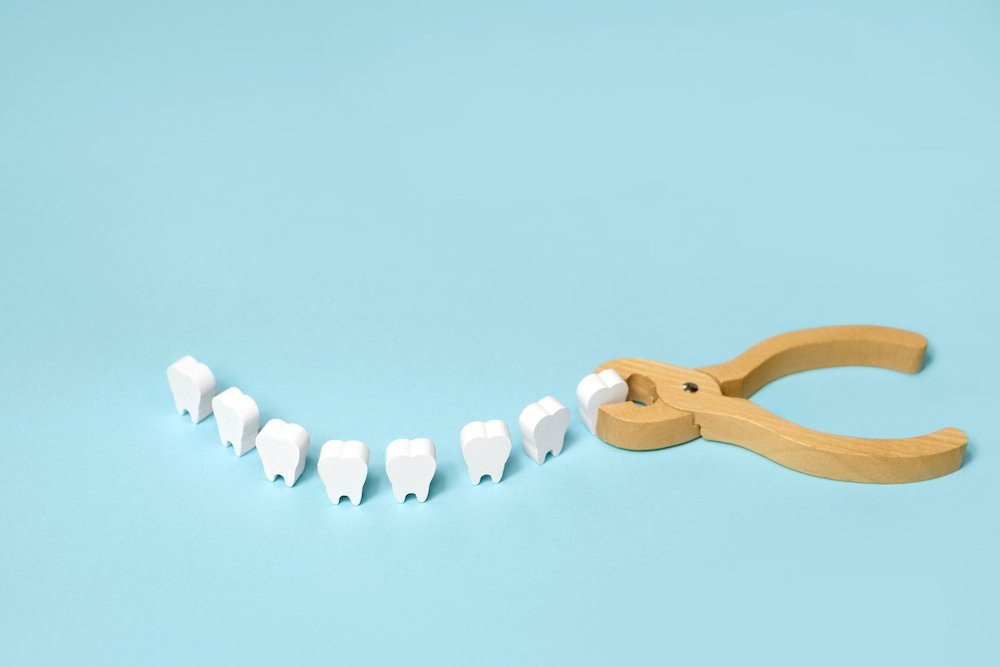 The Do’s and Don’ts to Follow After Tooth Extraction