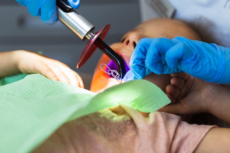 Post-Treatment Care for Children Following Root Canal Treatment