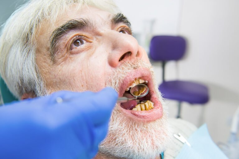 Senior Dental Care – How to Combat Tooth Decay and Gum Disease in the Elderly
