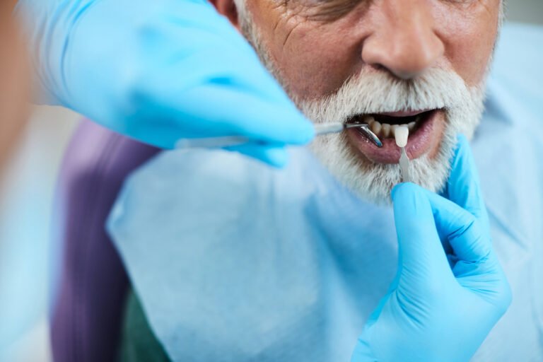 What Are the Materials Used in Creating Dental Implants