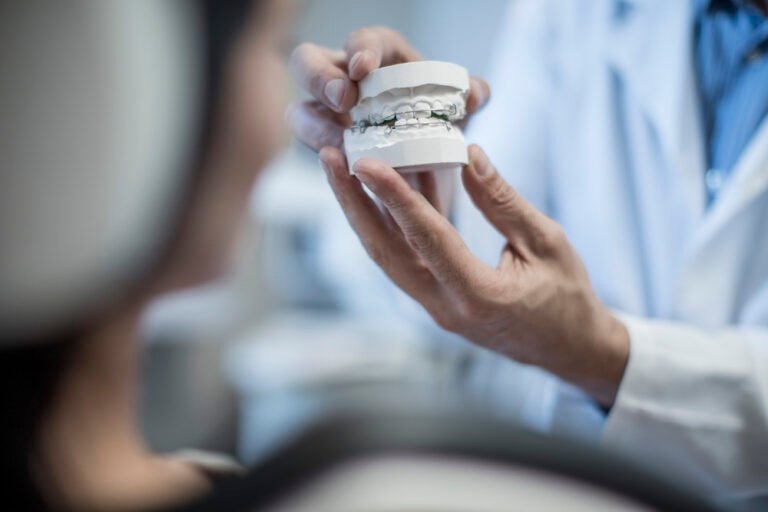 What to Expect after Orthodontic Treatment