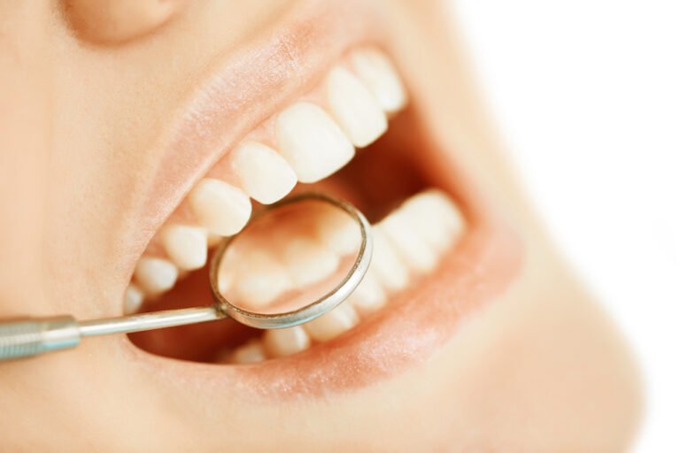 The Impact of Stress on Oral Health and How to Manage It