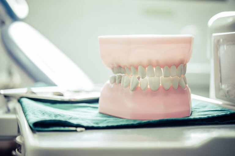 How Implant-Supported Dentures can be a Game-Changer for Tooth Replacement