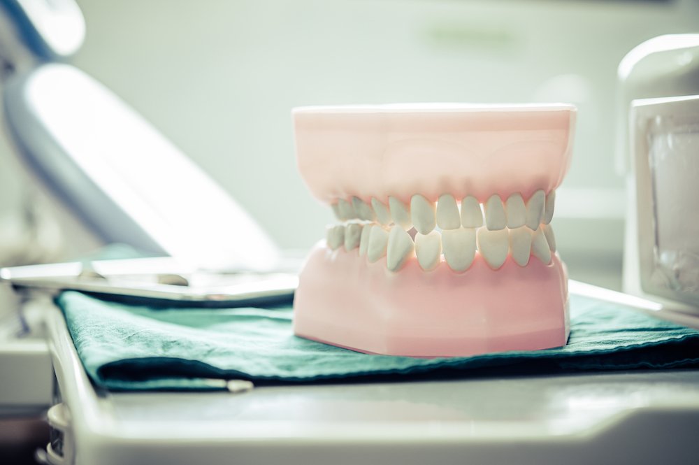 How Implant-Supported Dentures Can Help Replace Missing Teeth
