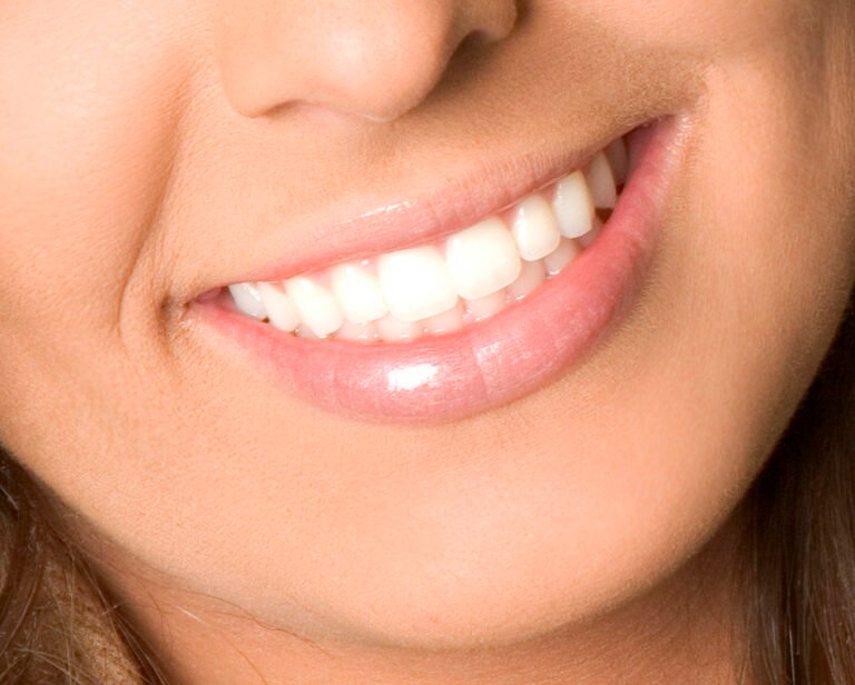 The Rising Prevalence of Bruxism: Causes, Impacts, and Dental Solutions