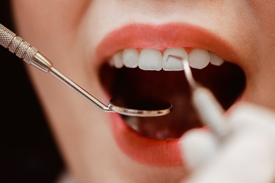 What is The Role of CBCT Imaging in Precise Dental Implant Placement