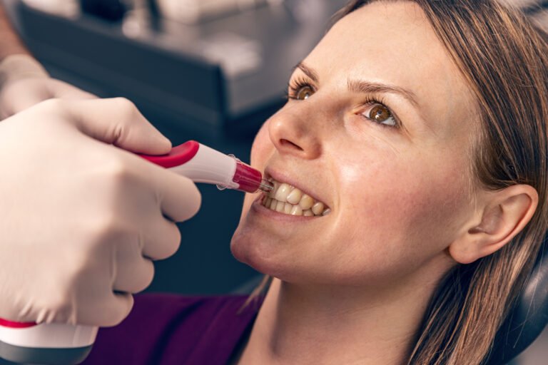 Your Ultimate Guide to Teeth Whitening in Calgary: Transform Your Smile and Boost Your Confidence