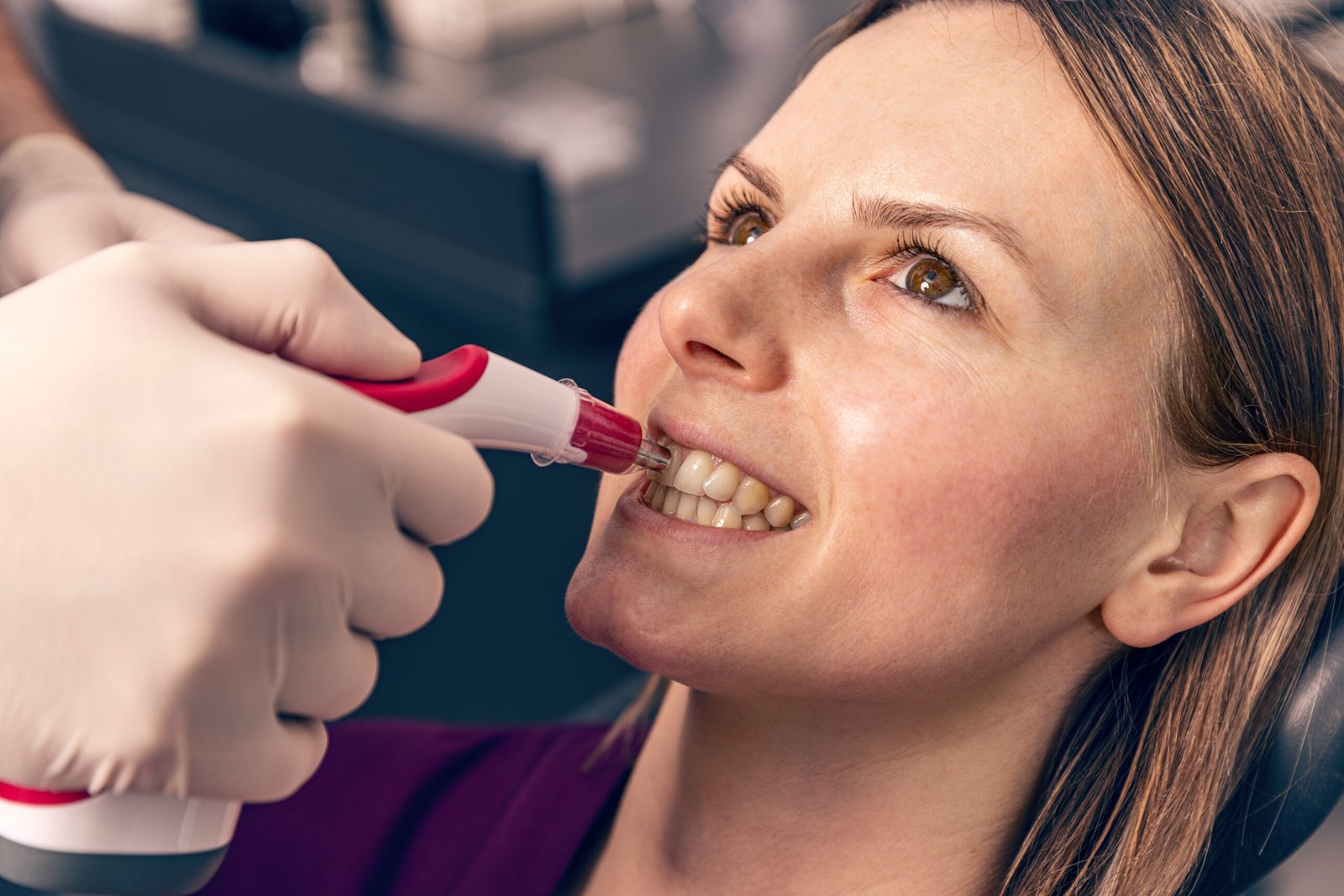 Your Ultimate Guide to Teeth Whitening in Calgary: Transform Your Smile and Boost Your Confidence