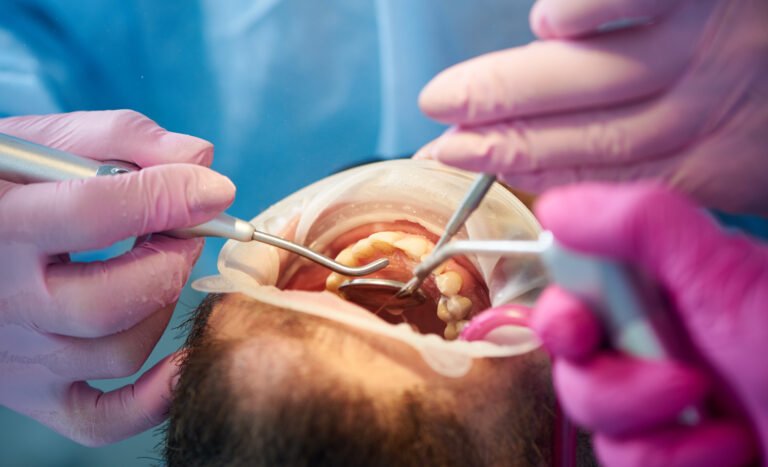 Understanding Gum Disease: Protecting Your Smile from an Invisible Foe
