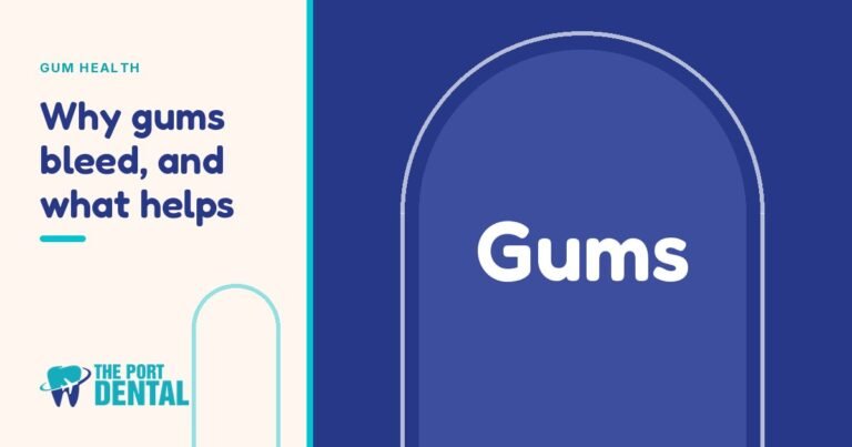 Bleeding Gums: Causes and When to See a Dentist