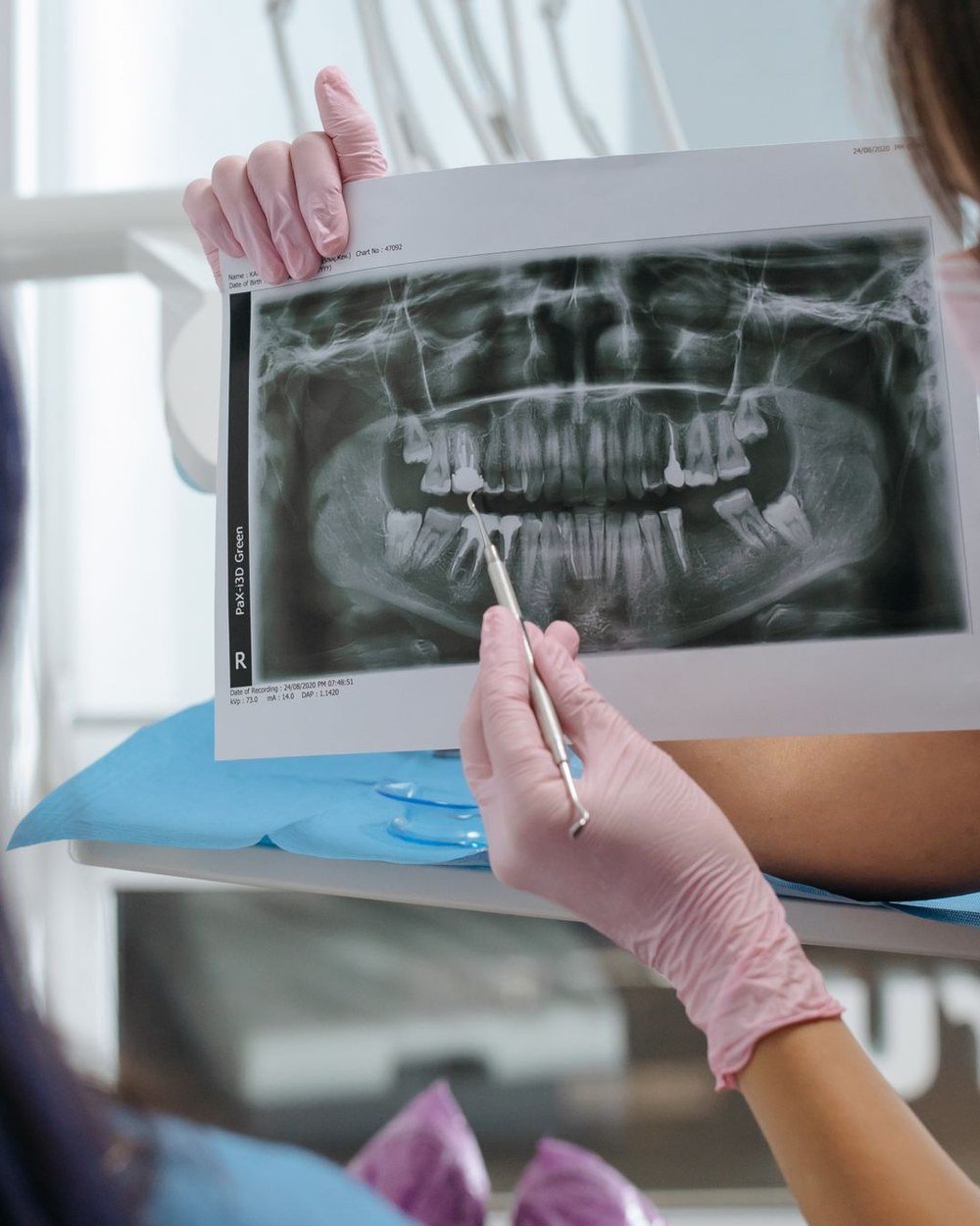 Dentist reviewing a treatment plan with a patient at The Port Dental Clinic in Calgary NE
