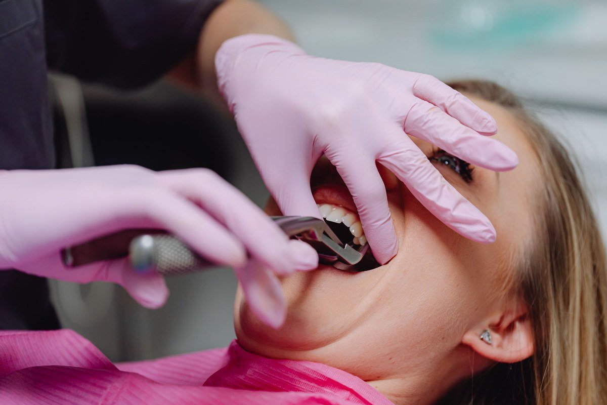 Dentist performing a tooth extraction with extraction forceps at The Port Dental Clinic in Calgary NE