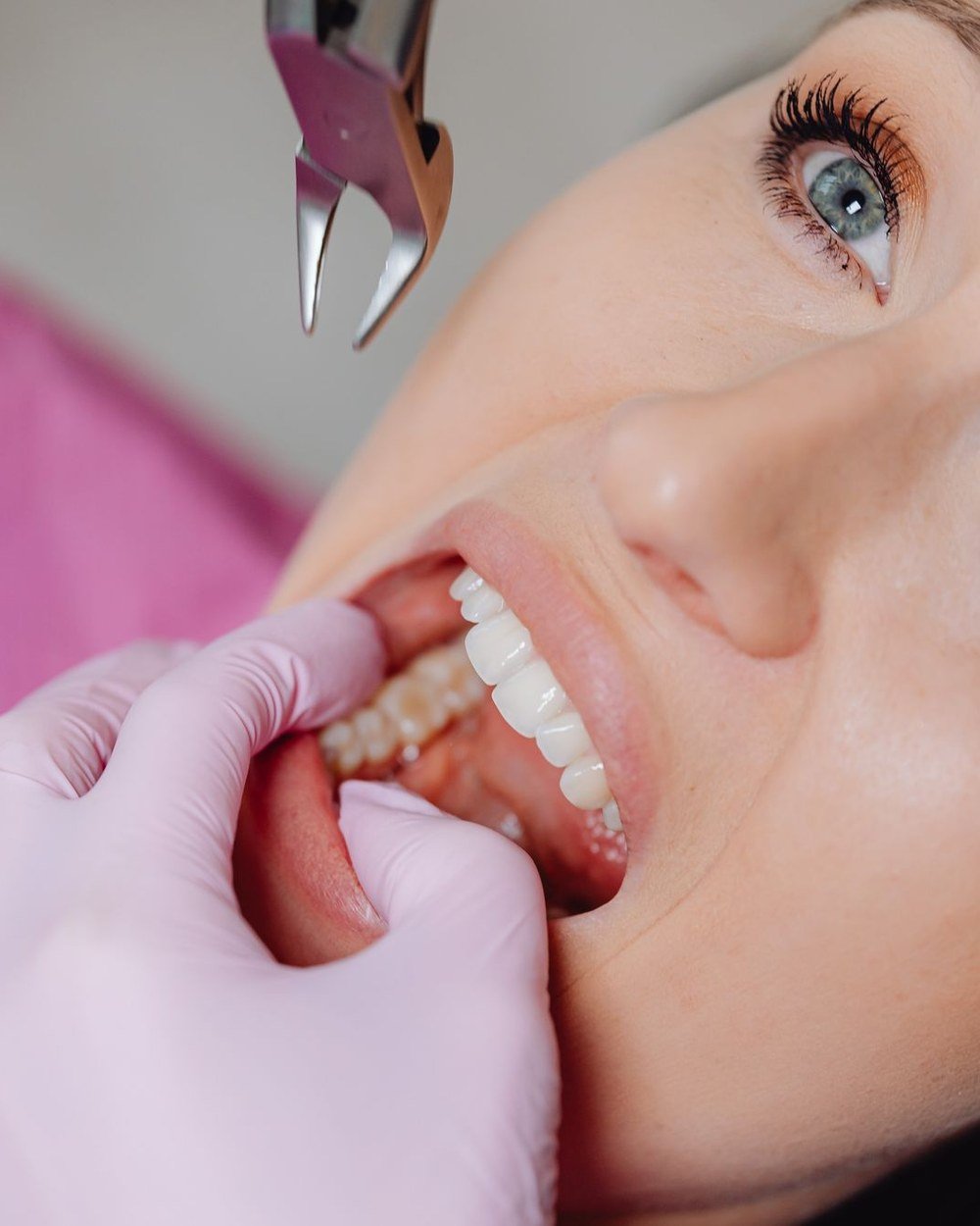 Calm patient during a gentle tooth extraction at The Port Dental Clinic in Calgary NE