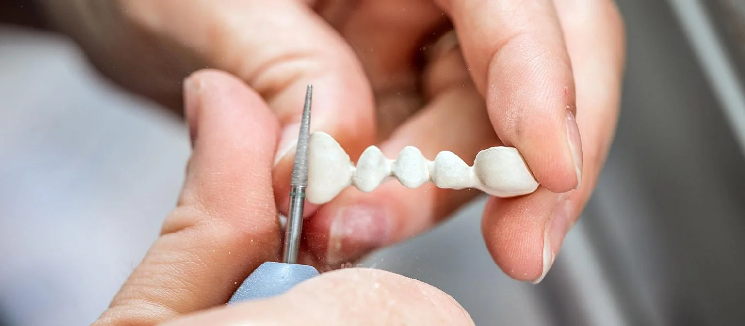 Patient receiving dental bridge consultation at The Port Dental Clinic in Calgary NE