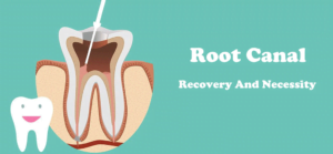 Root canal recovery time