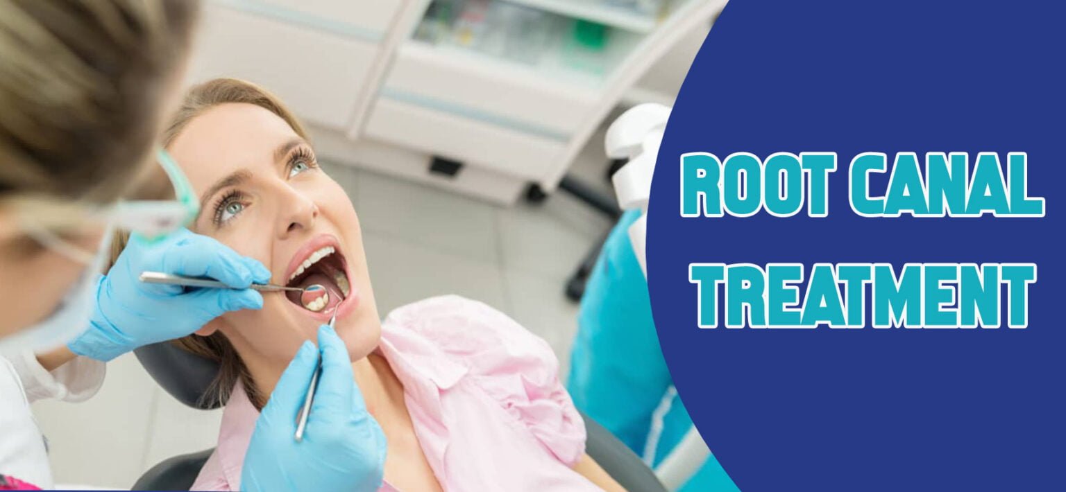 root canal treatment