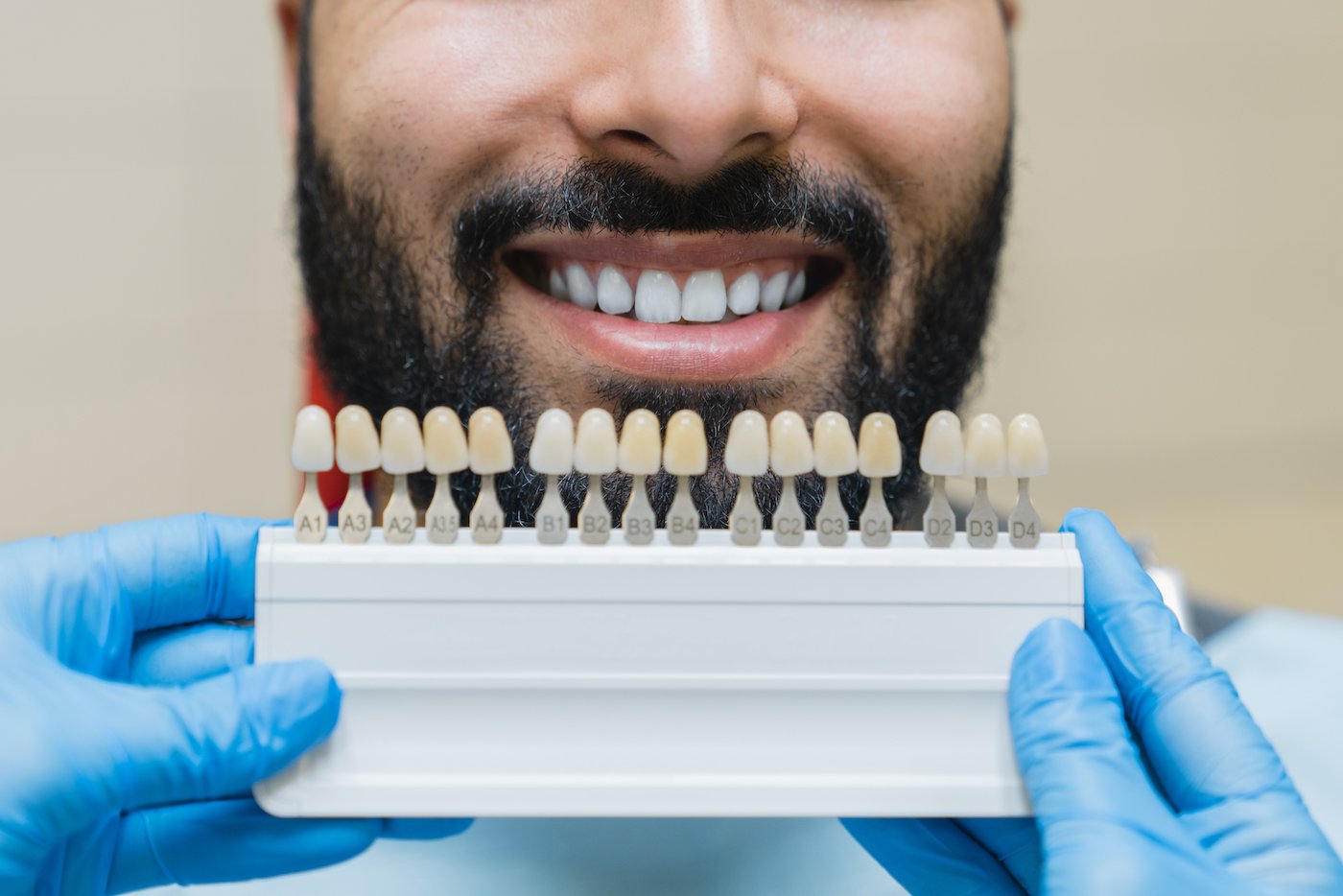 Ways to take care of your porcelain veneers