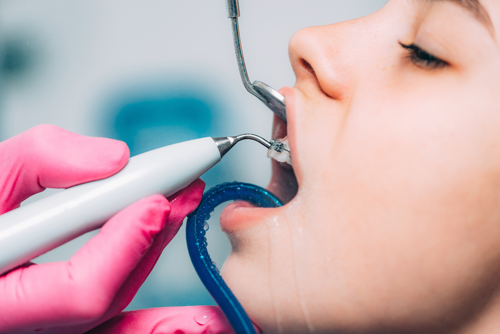 How often should you prefer professional dental cleaning, and why?