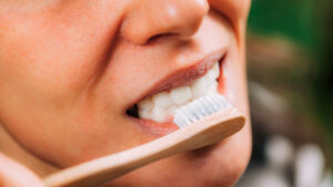 What are the Different Types of Professional Teeth Whitening Treatments?