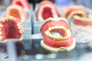 Dentures Lifespan: Factors Influencing Its Longevity and How to Expand its Lifespan